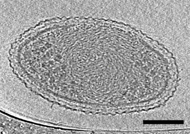 The internal structure of an ultra-small bacteria cell (Credit: Berkeley Lab)
