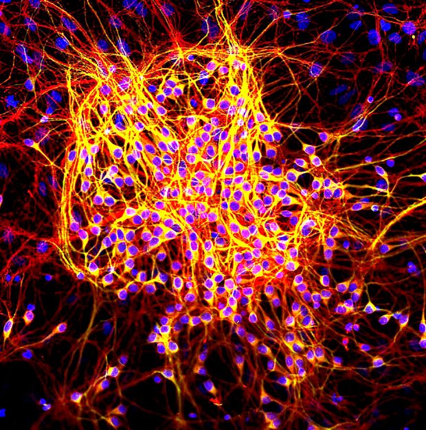 Tau protein in neurons (red). (Wikipedia.org)
